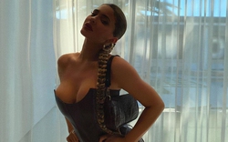 Kylie Jenner đang phải chữa bệnh gì?