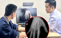 Thói quen ăn uống khiến người đàn ông nhiễm sán lá gan, ngứa cả năm