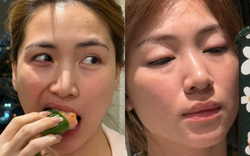 Hoà Minzy lộ nhan sắc sưng phù gây sốc