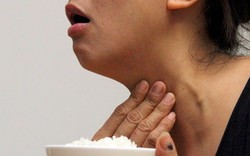 Bị nghẹn họng kéo dài tưởng bệnh dạ dày, người phụ nữ vô tình phát hiện tuyến giáp đã UNG THƯ