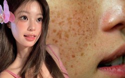 Hầu hết chị em đang bôi kem chống nắng kiểu này, bảo sao da sạm nám và nhăn nheo thấy rõ vào mùa hè