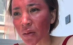 Không tẩy trang suốt 22 năm, người phụ nữ gây sốc khi mặt bị biến dạng