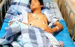 Chàng trai 17 tuổi suy thận giai đoạn cuối vì ăn quá nhiều 2 món nhưng vì "quá ngon" nên không ai từ chối