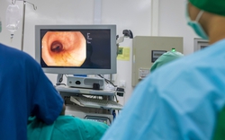 Ngày càng nhiều người còn trẻ đã khổ sở vì ung thư đại tràng, bác sĩ nghiêm mặt: 3 thứ này ăn càng ít càng tốt!