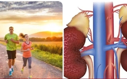 8 thói quen giúp thận khoẻ mạnh