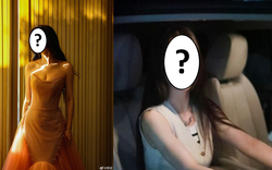 Một nữ diễn viên bị u xơ tử cung, "mắt lồi và sụt cân nhanh" và tái phát 3 tháng sau ca phẫu thuật