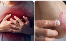 8 dấu hiệu cảnh báo thận không khoẻ