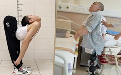 Chàng trai có cột sống gập hình chữ Z lần đầu đứng thẳng sau nhiều ca phẫu thuật