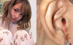 "Máu nhỏ giọt từ tai tôi", tiết lộ của Lisa (BlackPink) khiến nhiều người lo lắng: Chuyên gia chỉ ra nguyên nhân
