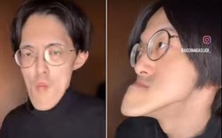 Người đàn ông có "chiếc cằm dài nhất thế giới", vẫn tiếp tục dài ra