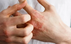 Câu chuyện về nỗi ám ảnh ‘nửa sống nửa chết’ vì loại thuốc hàng triệu người tin dùng