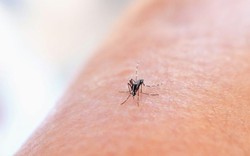 Chikungunya bùng phát ở nhiều nước, Bộ Y tế chỉ đạo khẩn