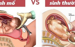 Chọn giờ sinh mổ để được "giờ tốt, ngày tốt": Những rủi ro ít mẹ lường được