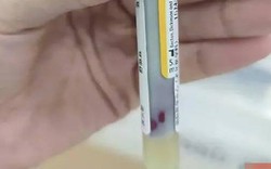 Máu "đặc quánh như sữa chua" vì 3 thú vui nhiều người có