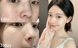 Không chạy theo xu hướng da "trắng sứ", tuổi 35+ tôi nhận ra rằng chỉ cần dưỡng đúng cách thì da sẽ sáng mịn từ bên trong