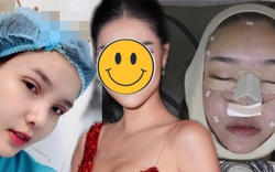 Người mẫu Việt tự khui ảnh thẩm mỹ mặt, thừa nhận rơi khủng hoảng vì sợ biến dạng vĩnh viễn