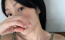 "1 đen, 1 tanh, 2 giảm" tưởng vô nghĩa nhưng lại là tín hiệu "chỉ điểm" ung thư dạ dày