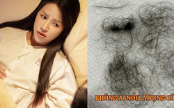 Puka gây lo lắng khi tóc rụng la liệt thành từng mảng sau khi sinh con đầu lòng