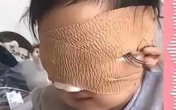 Bé gái 6 tuổi mất cả 2 mắt vì thứ nhiều bố mẹ vẫn cho con chơi mỗi ngày