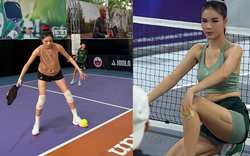 Rõ vết sẹo dài của Kỳ Hân sau tai nạn trên sân pickleball