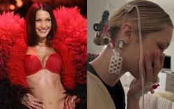 Em gái siêu mẫu của Gigi Hadid vật vã đau đớn vì căn bệnh nguy hiểm liên quan đến não