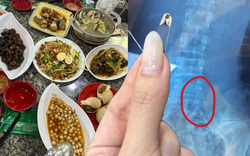 Đi ăn ốc, cô gái nuốt cả chiếc kim băng đang mở vào bụng, phải mổ cấp cứu 6 tiếng, tốn 70 triệu