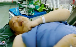 Mắc bệnh tim sau 1 năm chạy bộ mỗi sáng, nguyên nhân gây bất ngờ