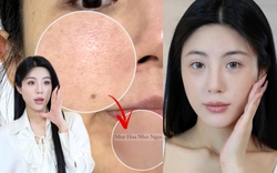 Cô nàng biến lỗ chân lông rộng ngoác thành nhỏ mịn nhờ 5 bước chăm da chuẩn khoa học