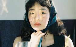 4 bất thường trên da là dấu hiệu của ung thư nhưng rất nhiều người KHÔNG HỀ HAY BIẾT!