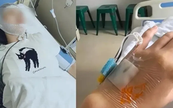 Dầm mưa 10 phút, người phụ nữ bị viêm màng não