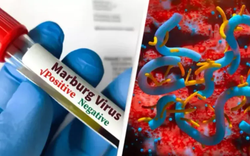 WHO cảnh báo "bệnh chảy máu mắt" lan rộng tại châu Phi