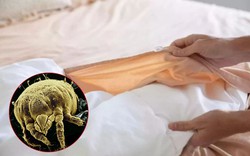 Vạch trần 2 ổ vi khuẩn rình rập ngay trên giường ngủ, bẩn đến mức không dám tin vào mắt mình!