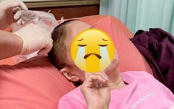 Nữ diễn viên truyền hình đình đám bàng hoàng vì bị mất 1 phần hộp sọ sau 5 ngày hôn mê