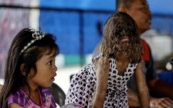 Cô bé “người sói” hiện ra sao?