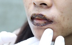 Làm đẹp cấp tốc, nhiều người 'tiền mất tật mang'