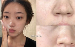 Thu nhỏ lỗ chân lông với 5 loại sữa rửa mặt làm sạch sâu mà không gây khô da
