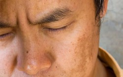 Cơ thể xuất hiện 4 biểu hiện bất thường này vào buổi sáng cảnh báo gan đang mang “mầm bệnh”: Có 3/4 thì phải đi khám ngay