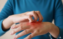 6 dấu hiệu rõ ràng cho thấy gan đang nhiễm mỡ