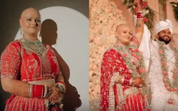 Cô dâu cạo trọc đầu trong ngày cưới và lý do bất ngờ