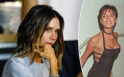 Victoria Beckham đã phải chịu đựng căn bệnh này suốt 25 năm qua