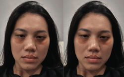 Dụi mắt không nhận ra Ánh Viên, sao lại ra nông nỗi này?