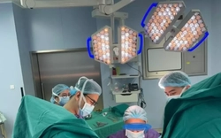 Vòng tránh thai 'đi lạc' vào bàng quang suốt 22 năm