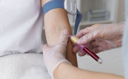 Phát hiện một phụ nữ mang nhóm máu cực hiếm, tỷ lệ 1/10.000