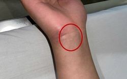 Bệnh viện Trung ương Quân đội 108 phát cảnh báo về 1 căn bệnh nguy hiểm, nhà nào cũng có nguy cơ mầm mống trú ngụ