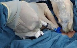 Phát hiện kịp thời, cứu sống bệnh nhi tràn dịch màng ngoài tim nguy kịch