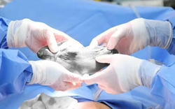 Đau bụng kéo dài, người phụ nữ đi khám phát hiện bí mật đáng sợ