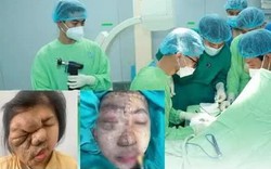 Phẫu thuật phức tạp tái tạo gương mặt cho cô gái 19 tuổi mang khối u suốt 17 năm