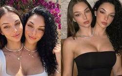 Cú lừa ngoạn mục của kỷ nguyên số: Cặp song sinh dính liền "vạn người mê" này thực chất là sản phẩm của AI