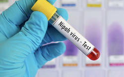 TPHCM tăng cường giám sát nhập cảnh, kiểm soát dịch bệnh Nipah