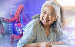 Mẹ chồng tôi bị ung thư trực tràng vì 1 thói quen tiết kiệm tưởng vô hại nhưng 30 năm sau bệnh không tái phát nhờ 3 thay đổi quan trọng